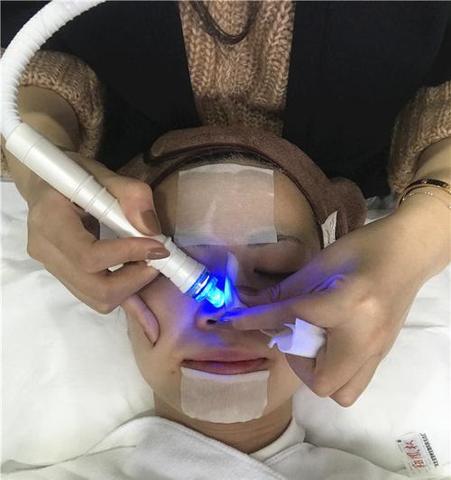 磨皮器充电器工作原理是什么？它如何提高磨皮效果？  第2张